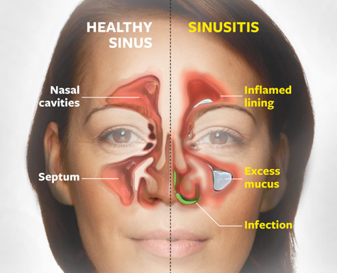 The location of your sinus