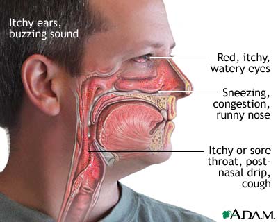 http://www.health32.com/wp-content/uploads/2010/11/allergy-symptoms.jpg