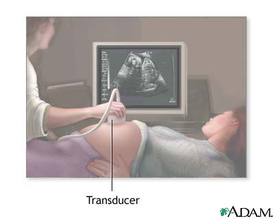 http://www.health32.com/wp-content/uploads/2010/11/ultrasound-in-pregnancy.jpg