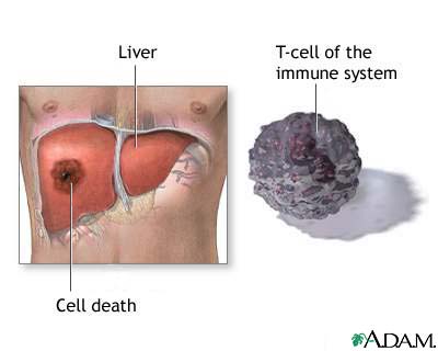 http://www.health32.com/wp-content/uploads/2010/12/liver-cell-death.jpg