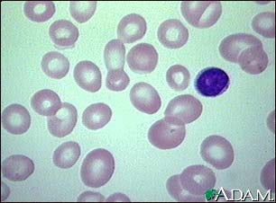 http://www.health32.com/wp-content/uploads/2010/12/megaloblastic-anemia-view-of-red-blood-cells.jpg