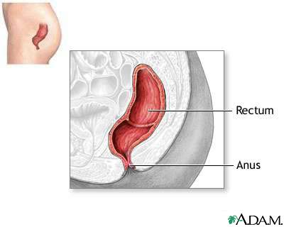 http://www.health32.com/wp-content/uploads/2010/12/rectum.jpg